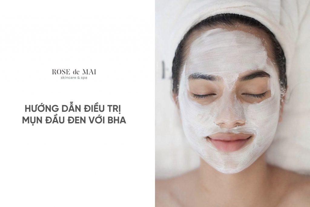 HƯỚNG DẪN ĐIỀU TRỊ MỤN ĐẦU ĐEN VỚI BHA ĐÚNG CÁCH