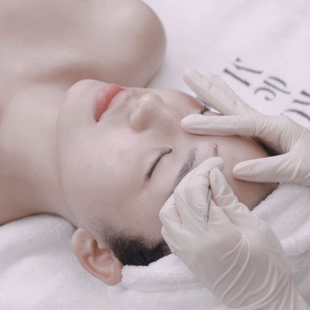 Đối tượng phù hợp cho peel da