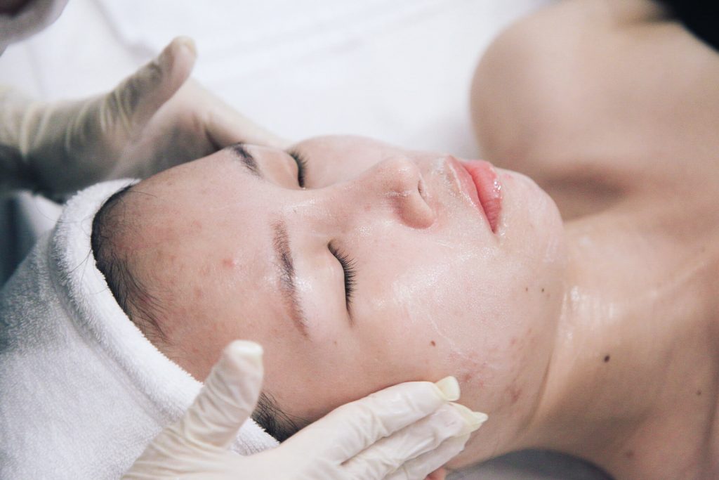 Nguyên nhân không nên lấy nhân mụn tại nhà