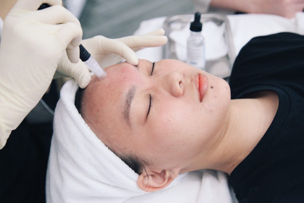 Hút chất bã nhờn và các nhân mụn li ti