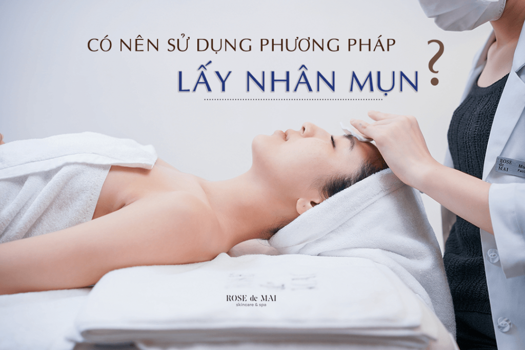 Bạn có nên sử dụng phương pháp lấy nhân mụn không?