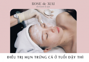 Điều trị mun trứng cá