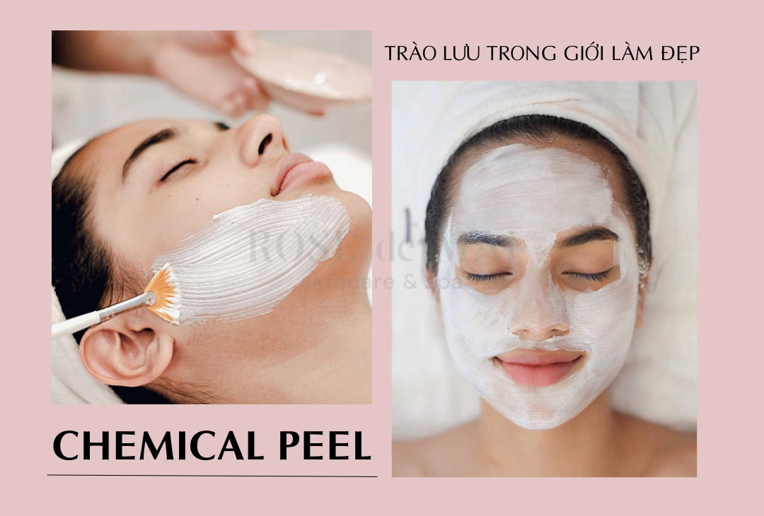 Chemical peel