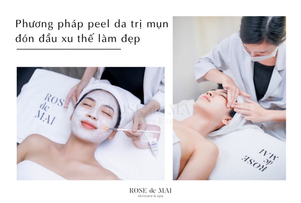 Phương pháp peel da trị mụn đón đầu xu thế làm đẹp