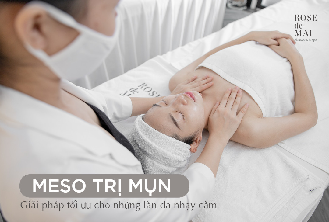 Meso trị mụn - Giải pháp tối ưu cho làn da nhạy cảm