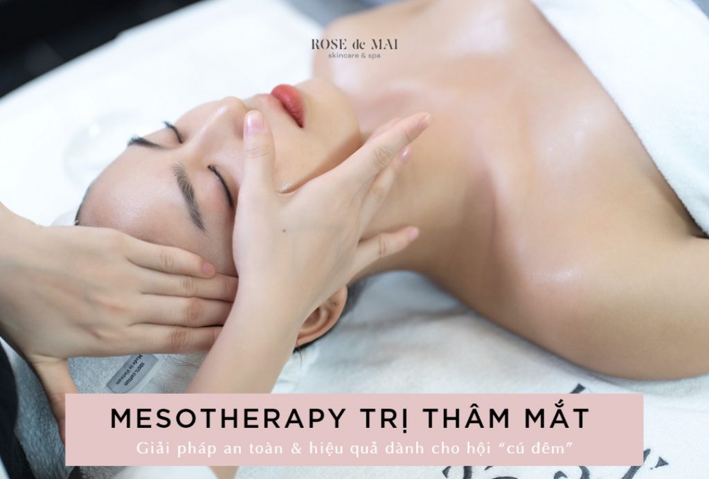 Mesotherapy trị thâm mắt – Giải pháp an toàn, hiệu quả cho hội cú đêm