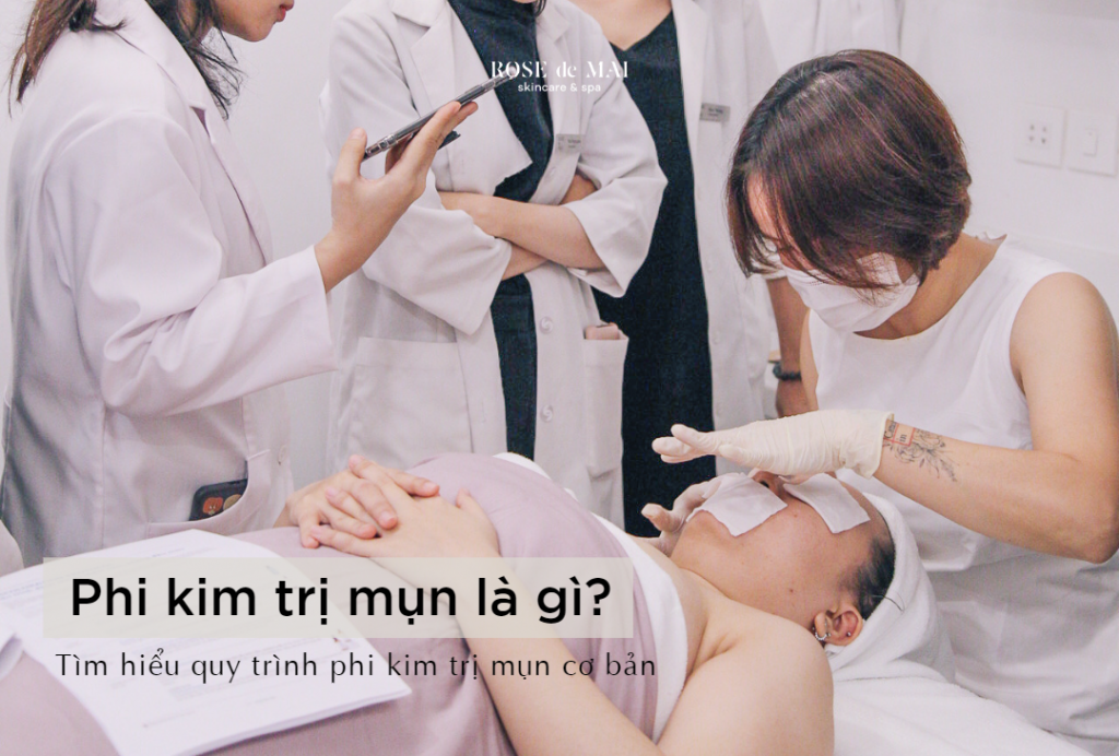 phi kim trị mụn