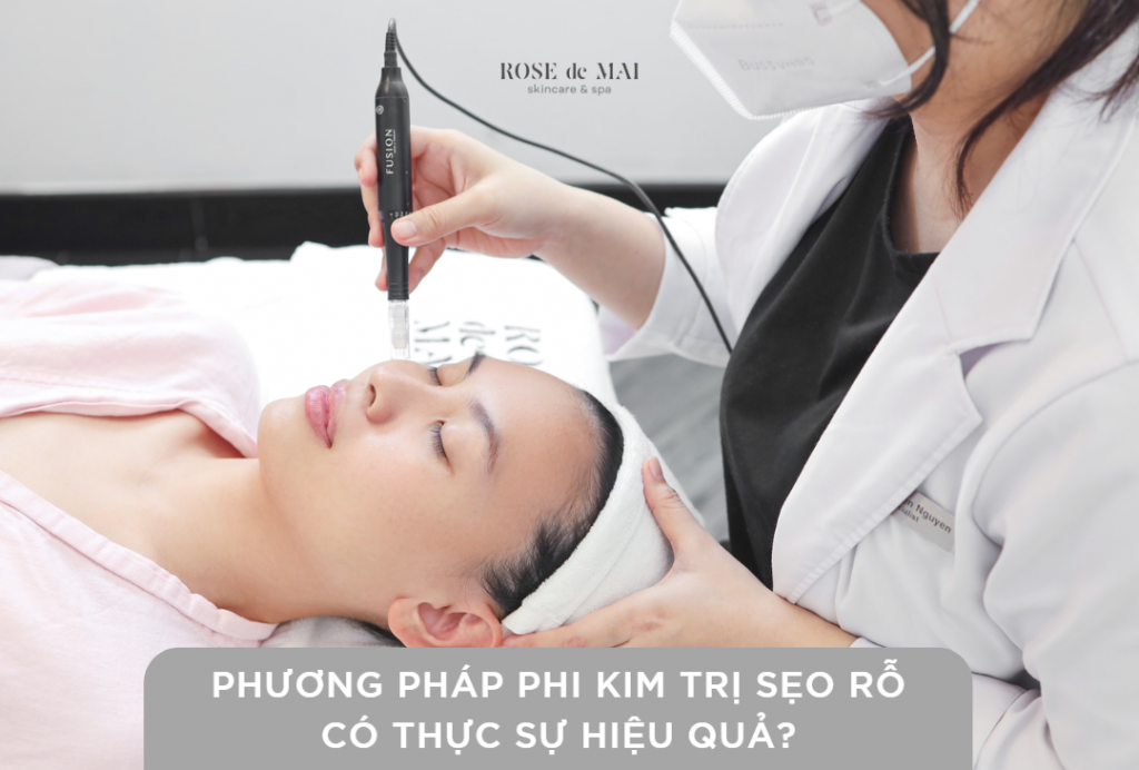 phi kim tri seo ro