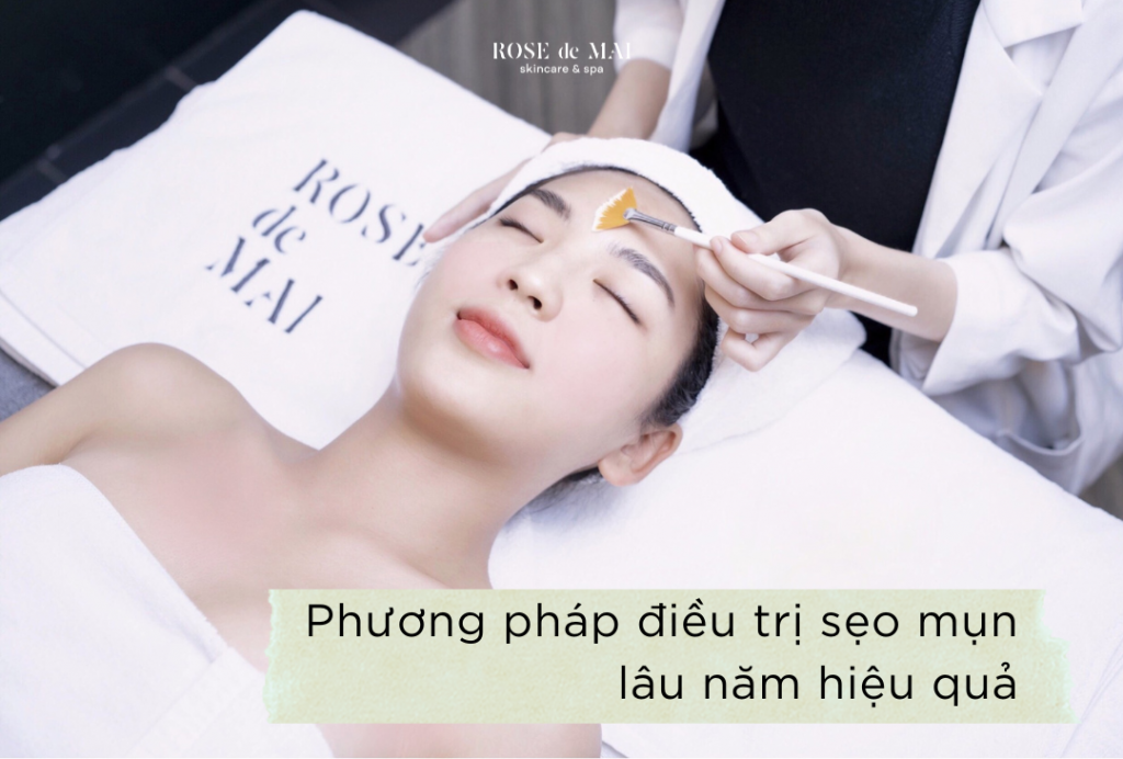 Phương pháp điều trị sẹo mụn lâu năm hiệu quả